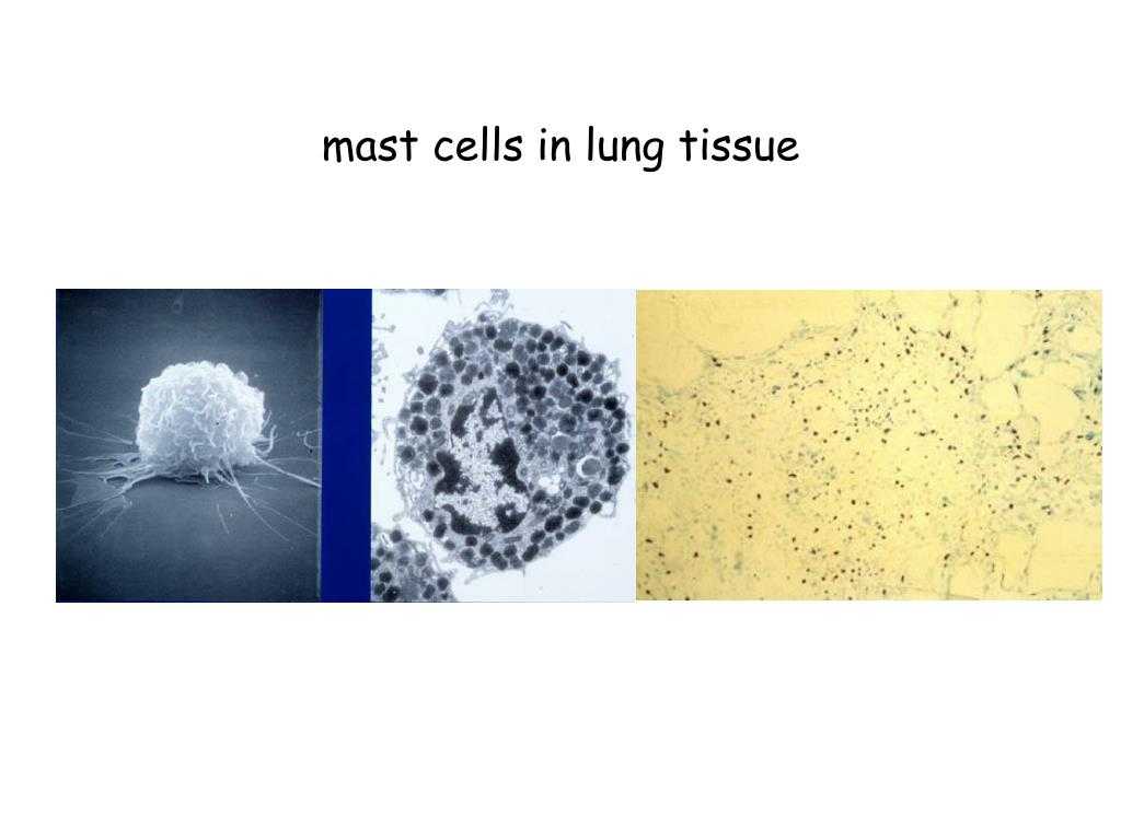 Organelles In Eukaryotic Cells Worksheet Also Ppt Mast Cells In Lung Tissue Powerpoint Presentation Id