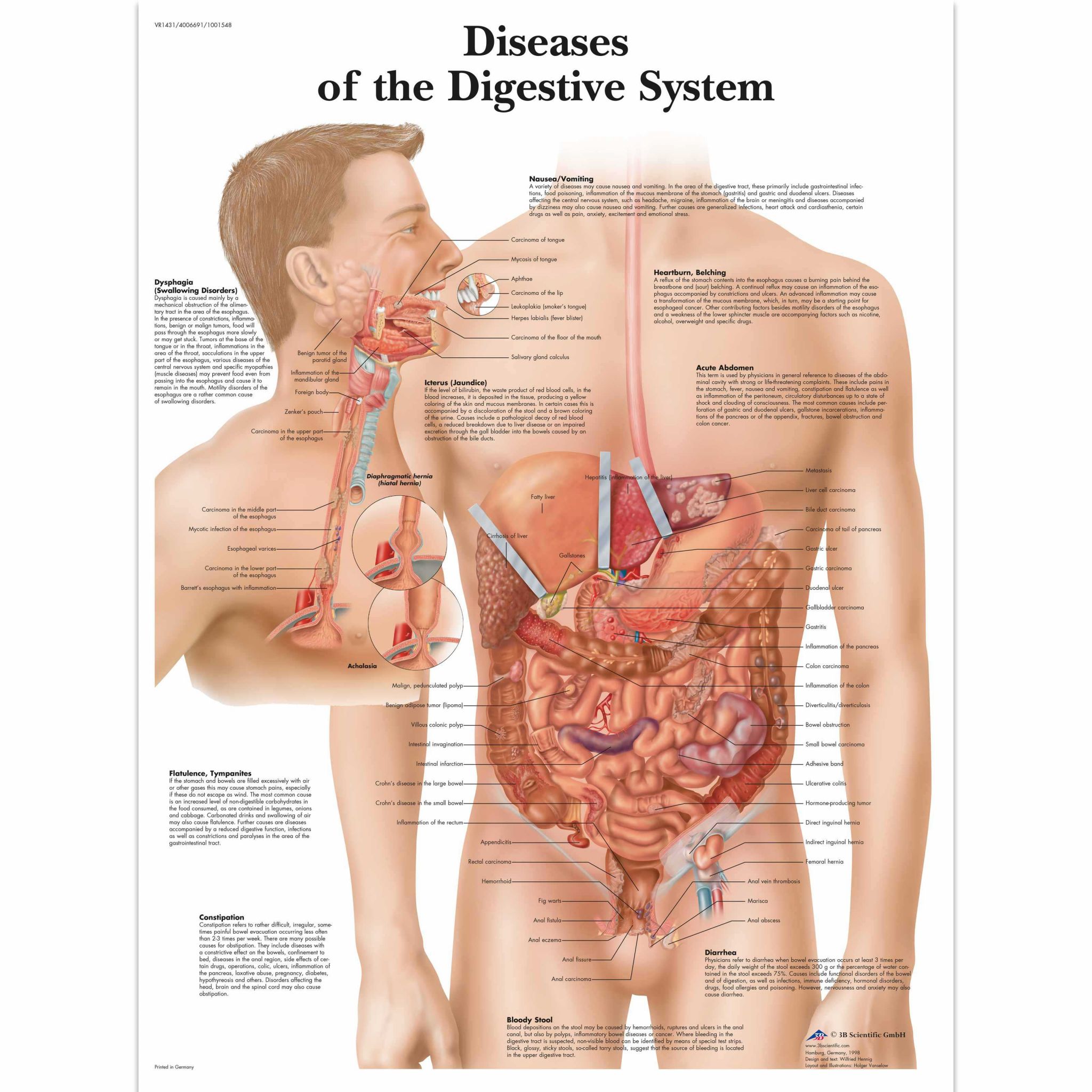 Digestive System Worksheet Answers together with Diseases the Digestive System Diseases the Digestive System