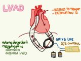 Anatomy and Physiology Worksheets Also Lvad Emergency Care Bing Images