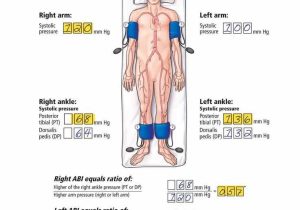 Ankle Brachial Index Worksheet Along with 171 Best Us Arteries Images On Pinterest