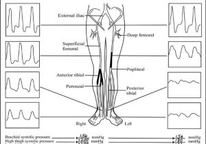 Ankle Brachial Index Worksheet with 171 Best Us Arteries Images On Pinterest