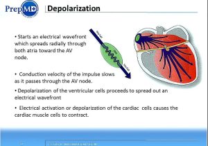 Conduction Convection and Radiation Worksheet Also Iprepmd Medical Device Training Fundamentals Of Ecgs and
