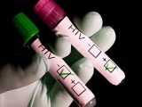 Hiv Aids Worksheet Along with Chelyabintsy Aktivno Prohodyat Test Na Vich