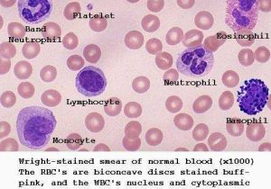 Human Blood Cell Typing Worksheet Answer Key together with 114 Best A&p 4 Heart Lung Images On Pinterest