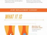 Joints and Movement Worksheet Along with 12 Best the West Lawn Podiatry Blog Images On Pinterest