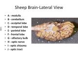 Sheep Brain Dissection Analysis Worksheet Answers with Brain Dissection Diagram Brain Dissection Diagram Human An