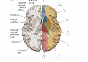 Sheep Brain Dissection Worksheet Also Brain Blood Supply Anatomy Blood Supply Brain Anatomy Bra