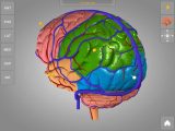Sheep Brain Dissection Worksheet as Well as Neuroanatomy 3d Stereoscopic atlas Human Brain Mrs
