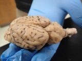Sheep Brain Dissection Worksheet together with Sheep Brain Dissection Anatomy Corner