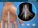 Virtual Hip Replacement Surgery Worksheet Answers and Virtual Carpal Tunnel Surgery iPhone Ipad