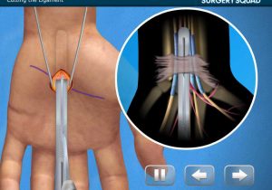 Virtual Hip Replacement Surgery Worksheet Answers and Virtual Carpal Tunnel Surgery iPhone Ipad