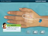 Virtual Hip Replacement Surgery Worksheet Answers with Image Of Surgery Squad