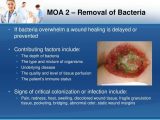 Viruses Bacteria Worksheet Also Bacteria In Wound Healing to Pin On Pinterest the